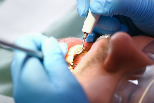 Best Dentist for Tooth Abscess  in Schleswig, IA