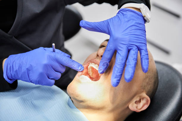 Tooth Infection Emergency Dentist in IA